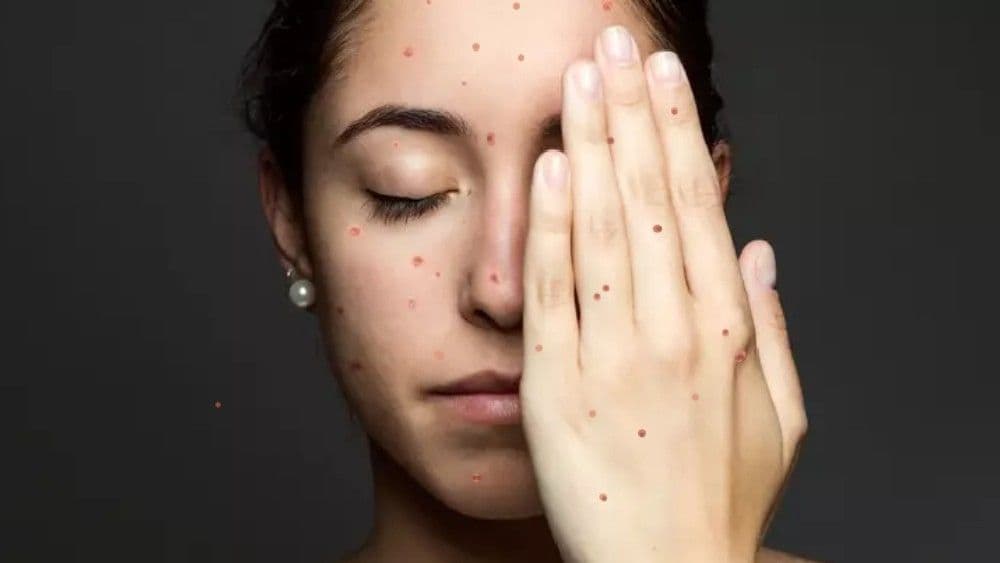 "SUPER"-stition Vs Medical Science